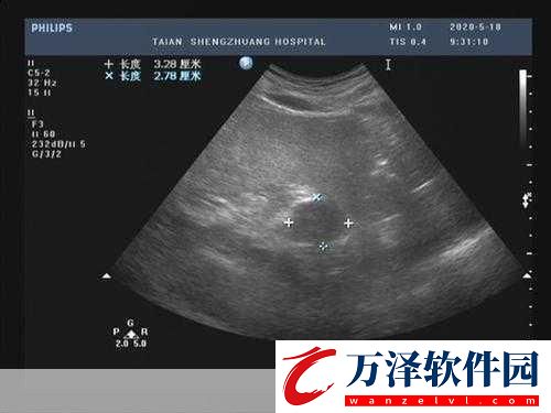 做超聲檢查時(shí)醫(yī)生為什么要在患者肚子上涂粘粘的東西